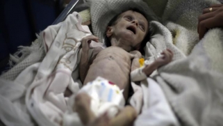 غارديان: صور صادمة لرضيعة سورية قتلها الجوع