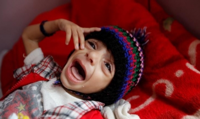 اليمن.. فواجع الحرب ورزايا الجوع والمرض