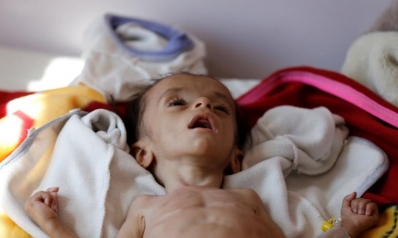 حصار اليمن يلغي 23 رحلة جوية للمساعدات