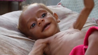 واشنطن تعرقل قرارا دوليا بشأن المجاعة في اليمن