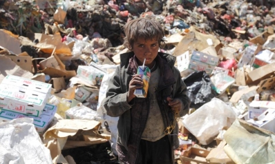 اليمن.. عندما تكون مخيرا بين الموت جوعا أو الموت بالكوليرا